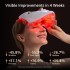Red Light Therapy for Face and Neck, Red Light Therapy Mask Portable Led Face Mask Cordless, Eye-Protection for True Anti-Wrinkles Skincare at Home